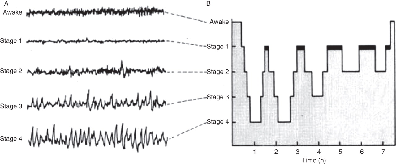 The different stages of sleep.